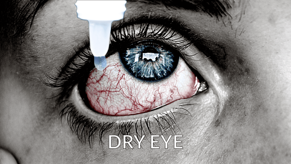 Retinol Effects on Eye Health: Preventing Dry&nbsp;Eyes